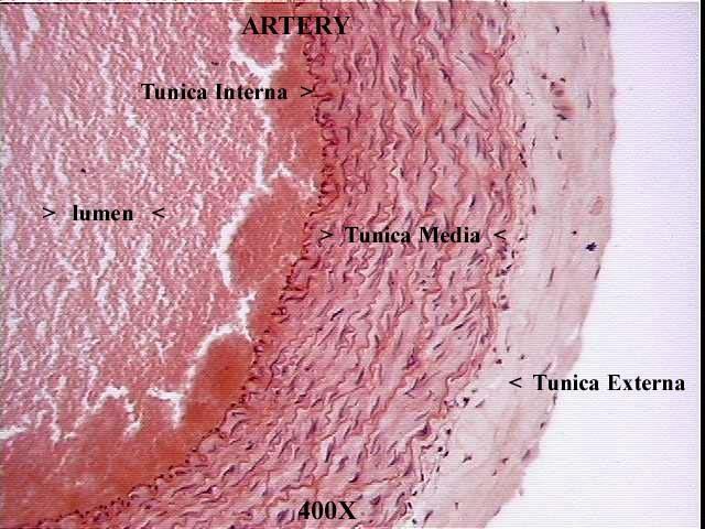 Artery 400x