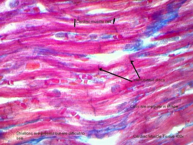 Cardiac muscle 400x