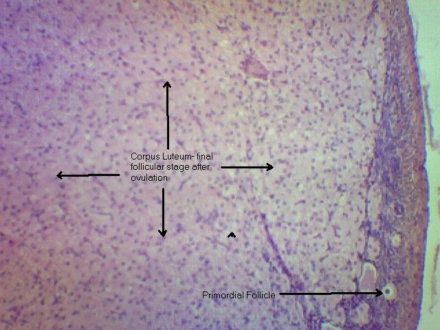 Ovary- corpus luteum 100x