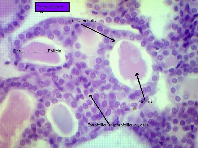 Thyroid gland 400x