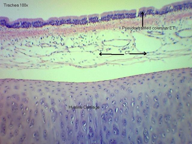 trachea 100x