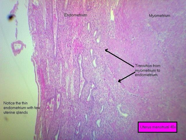 Uterus- menstrual 40x