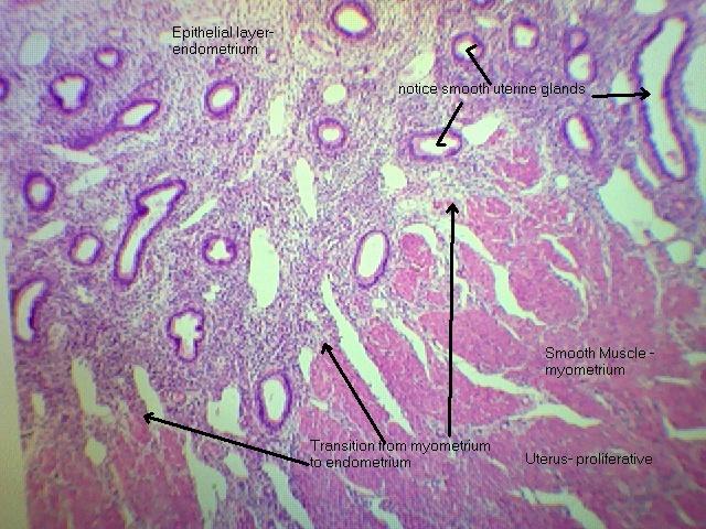 Uterus- proliferative 40x