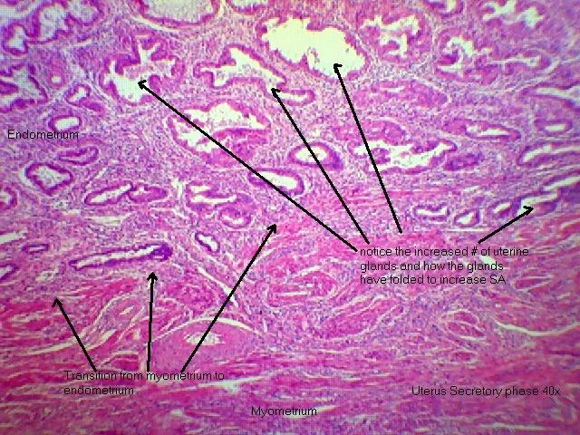 Uterus- secretory 40x