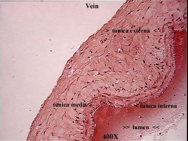 Vein 400x